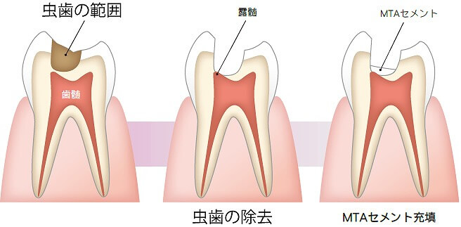 体に優しい安心の治療法